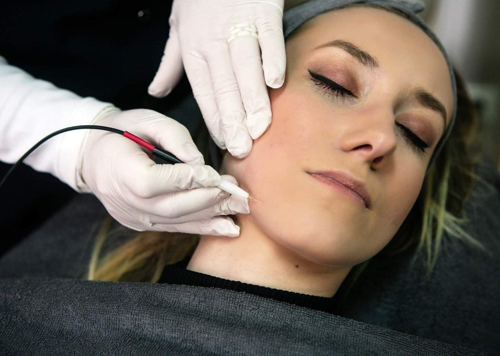 Hair removal